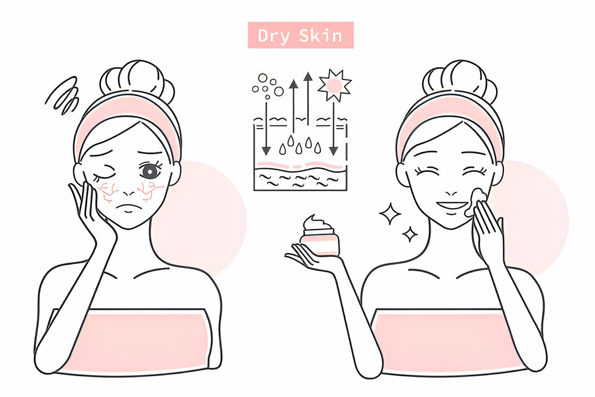 Why Skincare is Important For Dry Skin